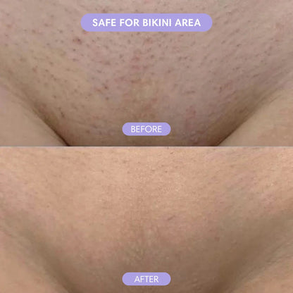 Lumotify™ - Mousse depilatoria para hombres y mujeres